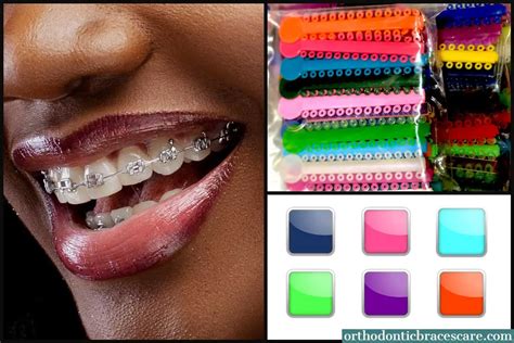 braces colors combination.